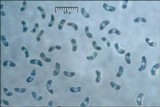 Cinereomyces lindbladii image