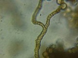 Arcyria ferruginea image