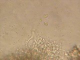 Stypella subgelatinosa image