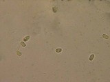 Stypella subgelatinosa image