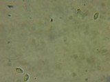Chromosera cyanophylla image