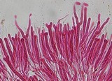 Dacrymyces chrysocomus image
