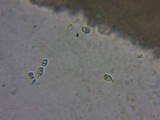 Mucronella bresadolae image