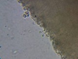 Mucronella bresadolae image