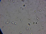 Mucronella bresadolae image