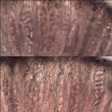 Trapelia coarctata image