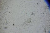 Cryptodiaporthe salicina image