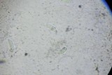 Cryptodiaporthe salicina image