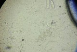 Cryptodiaporthe salicina image