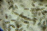 Melanconiella spodiaea image