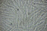Valsa salicina image
