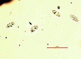 Caloplaca arenaria image
