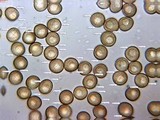 Trichia botrytis var. botrytis image