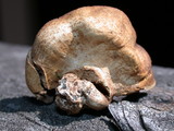 Scleroderma areolatum image