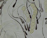 Scutellinia crinita image