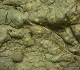 Pertusaria epixantha image