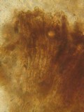 Inocephalus cystomarginatus image