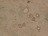 Inocephalus cystomarginatus image