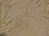 Dacrymyces variisporus image