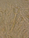 Dacrymyces variisporus image