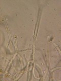 Dacrymyces variisporus image