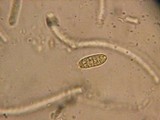Dacrymyces variisporus image