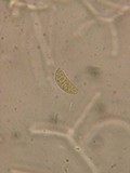 Dacrymyces variisporus image