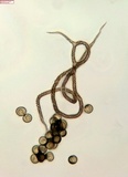 Trichia botrytis var. botrytis image