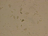 Ramaria rasilispora image