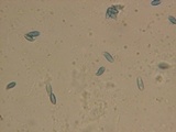 Ramaria rasilispora image