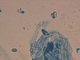 Lentaria pinicola image