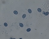 Scutellinia crinita image