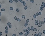 Scutellinia crinita image