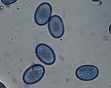 Scutellinia crinita image