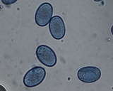 Scutellinia crinita image