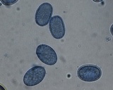 Scutellinia crinita image
