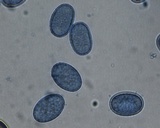 Scutellinia crinita image