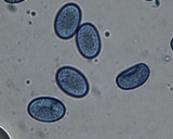 Scutellinia crinita image
