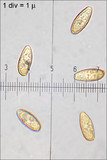 Boletus luridus image
