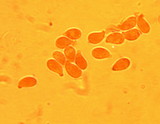 Clitocybe gibba image