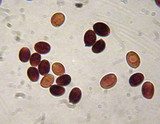 Leucoagaricus americanus image