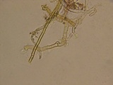 Tomentella galzinii image