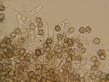 Tomentella galzinii image