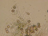 Tomentella galzinii image