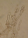 Thelephora wakefieldiae image