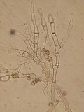 Thelephora wakefieldiae image