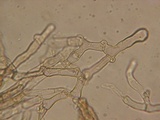 Thelephora wakefieldiae image