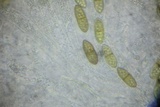 Amphisphaeria vibratilis image