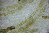 Amphisphaeria vibratilis image