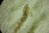 Amphisphaeria vibratilis image